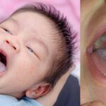 Close-up lidah bayi dan anak